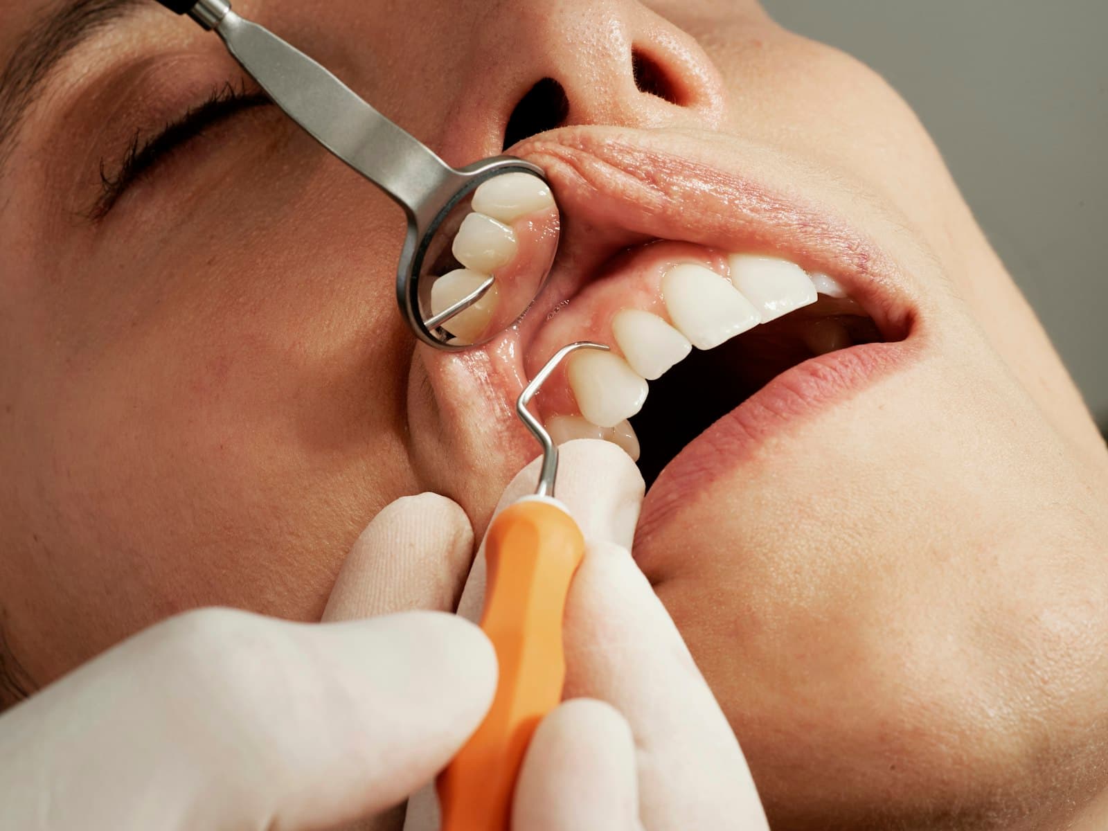 A Importância do Check Up Dentário Preventivo Periódico